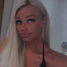 Can I ask how much ppl paying for crowns nobody seems to answer when asked  prices of surgery etc in turkey which really puts me off as I feel like  it's advertising