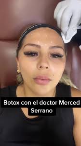 Botox con el doctor Merced Serrano