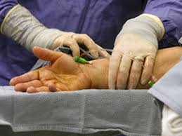 percutaneous coronary intervention ile ilgili görsel sonucu