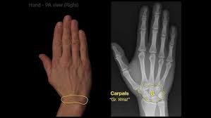 Image result for Normal Anatomic Position of the Hand and Wrist