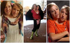 This episode contains a rare look at abby and brittany hensel, dicephalus conjoined twins, having two heads and sharing one. Abby And Brittany Hensel Restroom Real Answers To Questions You Ve Always Had About Conjoined Twins The Two Became Household Names After They Let The Media Into Their Unique Lives For