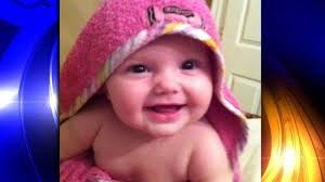 Birth defect leaves baby without bottom