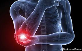 Fibromyalgie Symptome Ursachen Behandlung Meine Gesundheit