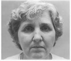 We did not find results for: Parkinson Disease Neupsy Key
