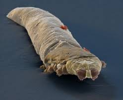 Image result for Demodex folliculorum