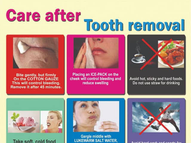 Tooth Removal product image