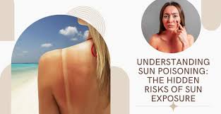 Image result for Sun Exposure