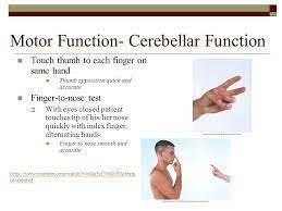 Image result for Cerebellar Function Test