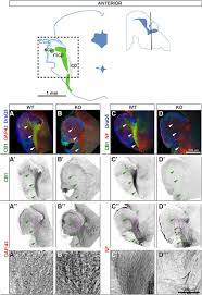Components of Endocannabinoid Signaling System Are Expressed in the  Perinatal Mouse Cerebellum and Required for Its Normal Development | eNeuro