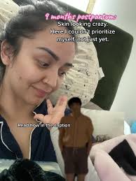 #CapCut first photo I was nine months postpartum, breastfeeding, sleep  deprived, eating a lot, so I could keep producing milk, and no matter how  much water I drank, I was still dehydrated. And you can ...