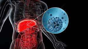 Cbd = common bile duct, cd = cystic duct, chd = common hepatic duct, ha= hepatic artery, ivc. 3d Liver Disease Scene Creative Image Picture Free Download 401808337 Lovepik Com