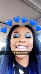 Black And Blue Braces Together Credit Before Reposting Give It Sus Xoxo Shesoboujie Braces Colors Braces Teeth Colors Brace Face