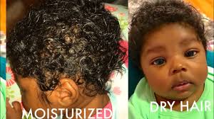 Hair usually starts to shed at 8 to 12 weeks of age, and begins to grow back at around 3 to 7 months. How To Moisturize Grow Baby S Hair Or Remove Cradle Cap Detailed Youtube