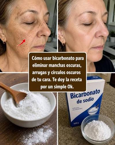 Manchas, arrugas u ojeras? Usa bicarbonato así — receta fácil en el primer  comentario.👇✓