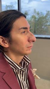 27 days post-op: Our patient sought a more proportionate nose and balanced  facial features. Dr. Mentz recommended chin augmentation alongside the  septorhinoplasty for enhanced harmony. While some ...