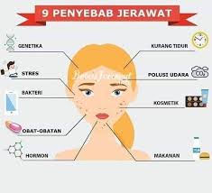 Munculnya jerawat ternyata bukan hanya disebabkan karena wajah yang kotor atau jarang membersihkan wajah. Drw Skincare By Dr Wahyu Triasmara 0895353666934 Berikut Ada 9 Faktor Penyebab Jerawat 1 Penyebab Jerawat Akibat Perubahan Hormonal Pada Tubuh Jerawat Dapat Menyerang Siapa Saja Jerawat Bisa Tumbuh Subur Pada Usia
