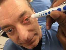 PupilScreen: Using Smartphones to Assess Traumatic Brain Injury