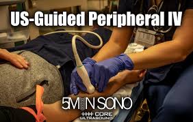 Image result for Peripheral IV Access