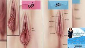 تخصيص الحرم الجامعي مرح تجميل الشفرات الداخلية comertinsaat com
