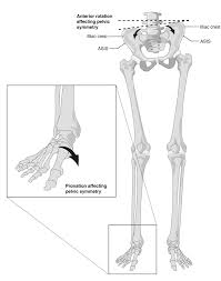 Pin On Foot Problem