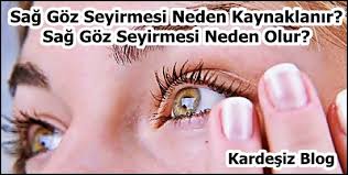 Sag Goz Seyirmesi Neden Kaynaklanir Sag Goz Seyirmesi Neden Olur