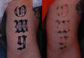 Find the best tattoo artists and tattoo parlors in houston. Piqo4 Laser Tattoo Removal Before After Photos Patient 160 Houston Tx Ovation Med Spa