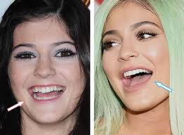 Atlanta dentists accredited in cosmetic dentistry; How Do Celebrities Get White Teeth Stanley Dentistry