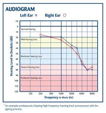 Audiology Diagnostic Assessment City Hearing Audiology
