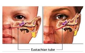 The volume of the crackling is not always constant and will fluctuate. Why Are My Ears Crackling And Popping Crystal Clear Clinic