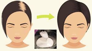 Prima di tutto, il bicarbonato aiuta a mantenere equilibrato il ph dei capelli, . Bicarbonato Di Sodio Salvezza Per I Capelli Ecco Perche