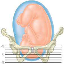 A Guide To The First Stage Of Labor Effacement And Dilation Familyeducation