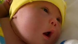 Dad refuses to give up newborn son with Down syndrome after wife leaves him