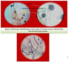 Image result for Uncinula necator