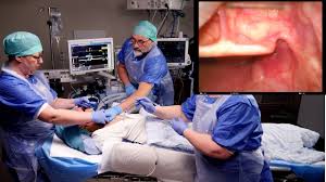 What does being intubated mean? Endotracheal Intubation Youtube