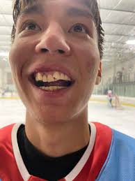 I've seen this guy live before. He can play with his teeth!