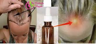 kadini kadin yapan saclaridir bu serum buyulu bir iksir gibidir sac gelisimini gercekten hair growth serum essential oils for hair coconut oil hair treatment
