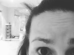 Baby hairs are the wispy, small hairs that appear right at your hairline. This New Mom Shows The Reality Of Postpartum Hair Self