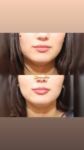 Tito Vasquez, MD (@titolvasquezmd) · Southport, CT