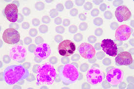 Image result for WBC