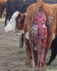 Image result for Retained Placenta