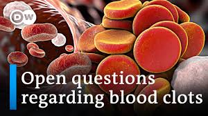 Following rare blood clots, the us, south africa and eu have suspended the jab. Who Astrazeneca Say No Causal Link Between Vaccine And Blood Clots Coronavirus Latest Youtube