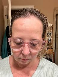 I wanted to show you my progress with F59 our so called Botox in a bottle.  It's contains paracress and Hydroxytyrosol. You can see the fine lines  getting less pronounced. The photo