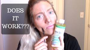 Castor oil can do wonders for the health of your hair. Castor Oil For Hair Results I Am Amazed Youtube