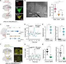 Minyak organik anti stress no.1 di malaysia. Cerebellar 5ht 2a Receptor Mediates Stress Induced Onset Of Dystonia Science Advances