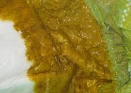 Is it bad to have undigested food in your poop? Baby Poo A Visual Guide Photos Babycentre Uk