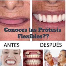 INVISIBLES EN BOCA.. MÁS LIVIANAS.. Mejor precio + Mejor Servicio + Mejor  Financiación Consulta y revisión sin costo www.laborartedental.com.uy