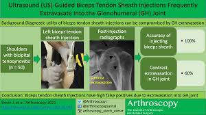 Image result for Biceps Tendon Injection