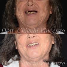 Chipa Dental Center added a new...