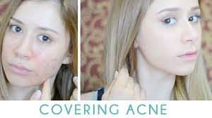 how to cover acne without looking cakey