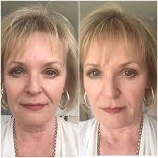 Real Help For Thinning Hair In Women Over 50 Thin Hair Styles For Women Thin Hair Help Hair Loss Women